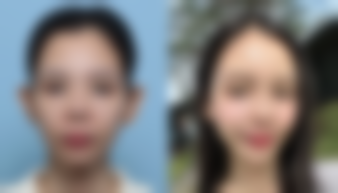 临汾雅美整形医院真人口碑评价怎么样？