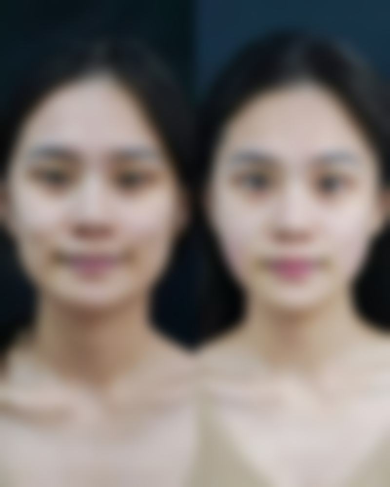 重庆军科整形VS华美整形，怎么选？｜军科擅眼鼻吸脂，华美长磨骨隆胸