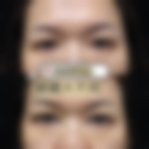 裴旭芳：自然妈生眼缔造者