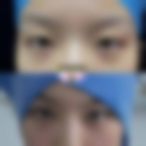 王小林：高难度眼修复骨干医生