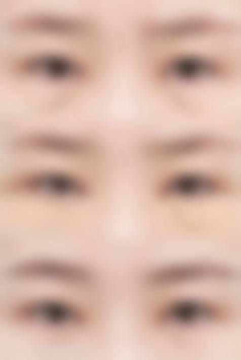 刘玉琨医生口碑评价及真人实例