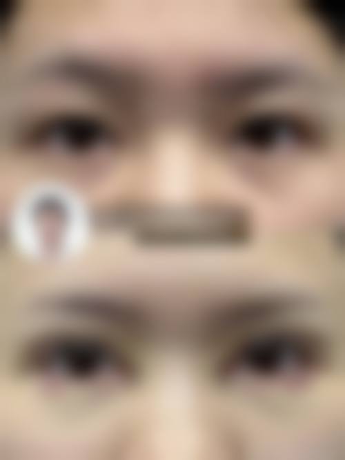 成都俏可丽整形医疗美容门诊部真人口碑评价怎么样？