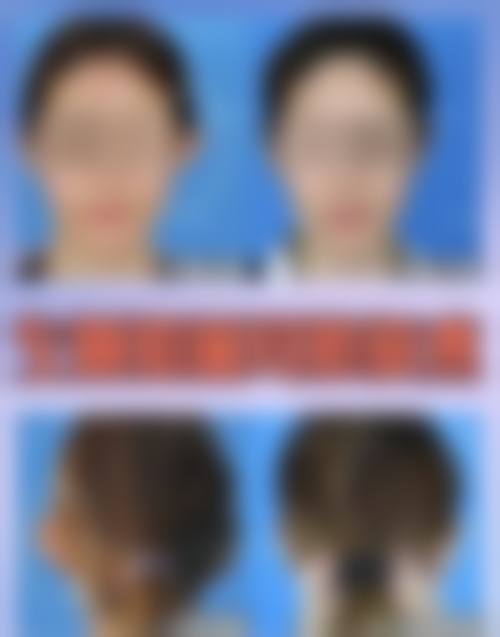 杨建医生预约挂号