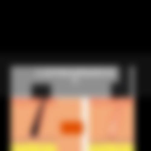 六、合肥曙光植发医院的价格是否合理