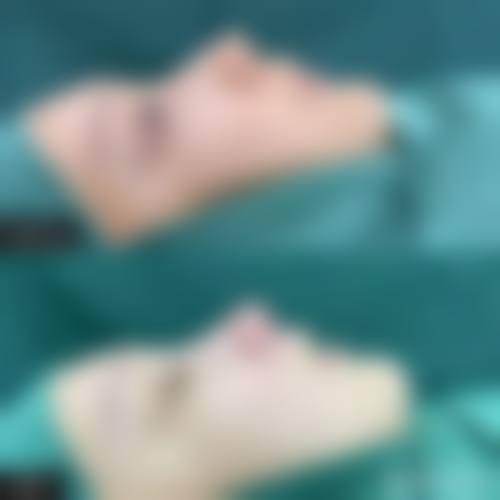 收费参考与价格区间