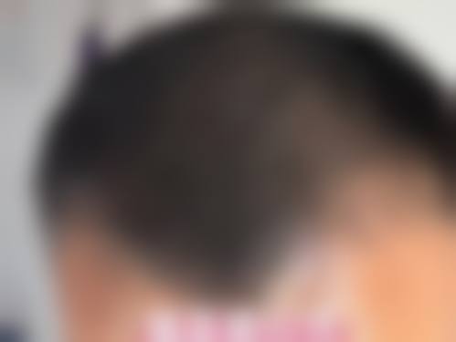 祝永红医生口碑评价及真人实例