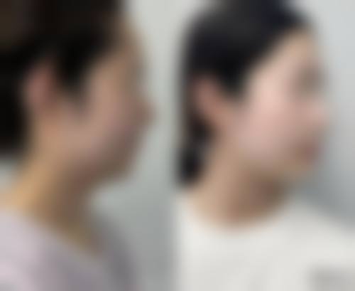 二、温州艺星医学美容正规吗？