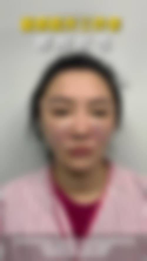 张路面部提升三件套怎么预约：上海九院周二周六专属，公众号/400-897-xxx可约