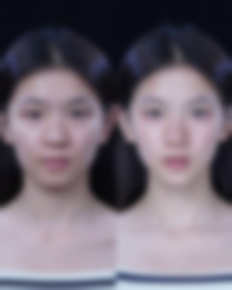 北大口腔医院:口腔整形的专精之选