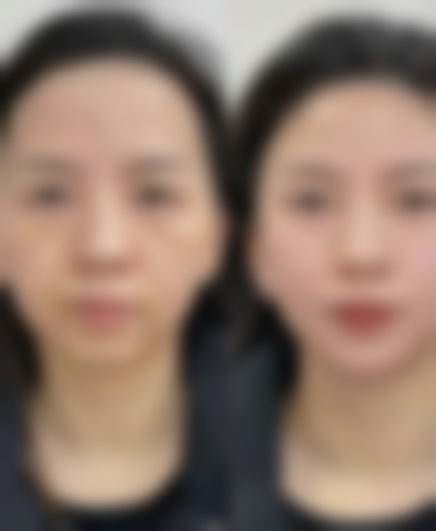 黄晓帝医生口碑评价及真人实例