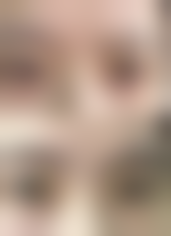 上海雅丰医疗美容诊所患者常见问题解答