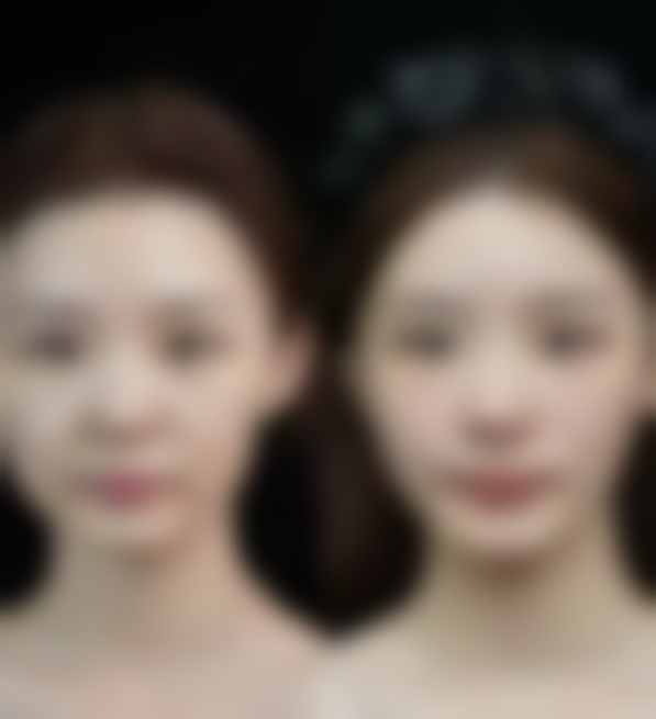 七、温州艺星医学美容收费价格表/收费标准