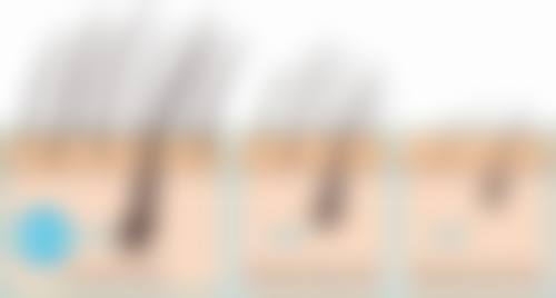 邓娟娟医生口碑评价及真人实例