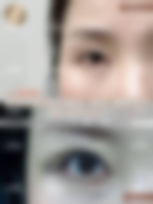 周仙娥医生口碑评价及真人实例