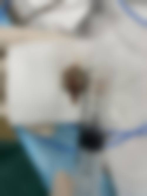 患者常见问题解答(精选)