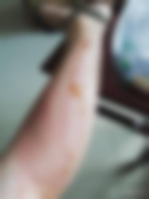 昆明市第一人民医院(整形美容科)价目表