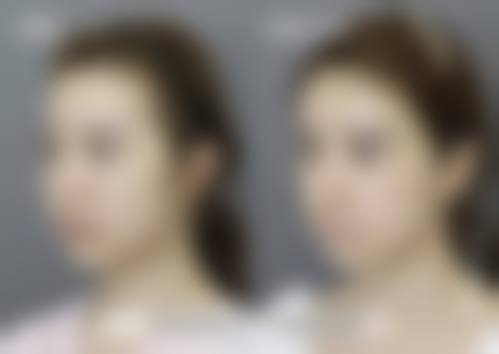 梁勇生医生擅长项目