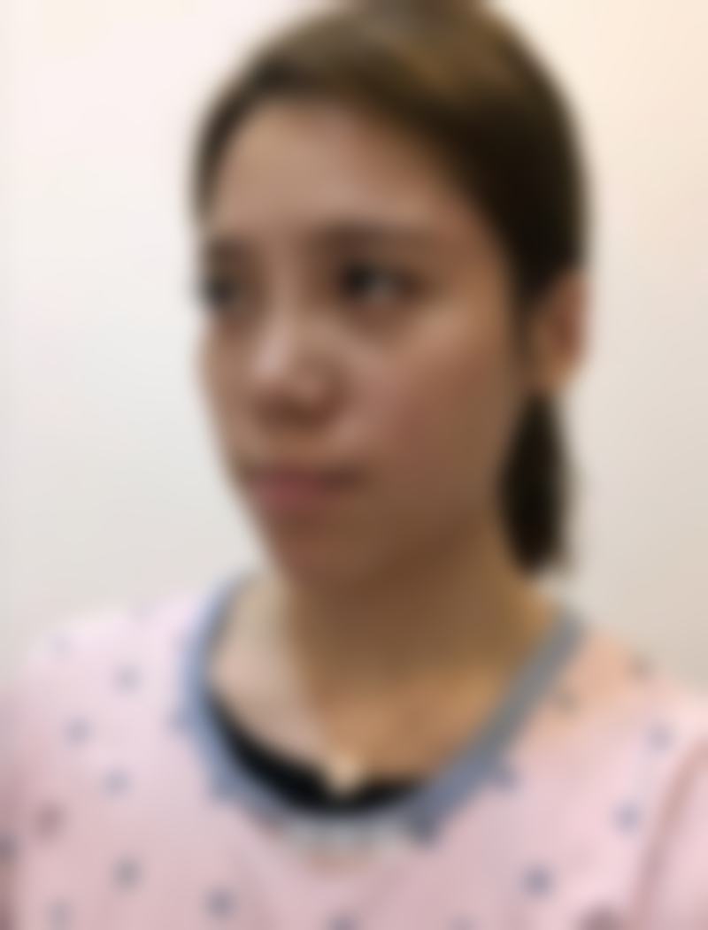 术后修复与成效呈现