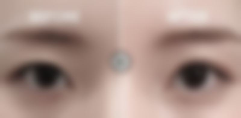 哈尔滨泽美医疗美容门诊部真人口碑评价怎么样？