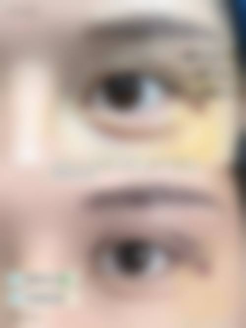 董欢医生技术优势