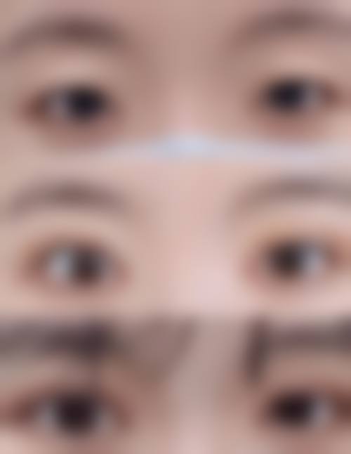 取生长因子技术优势