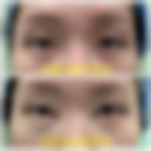 吉林李英医疗美容诊所真实实例