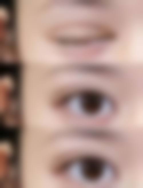 三、眼鼻定制项目的特色