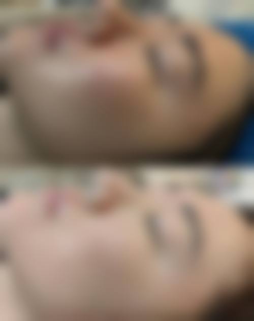 上海时光整形医院最擅长什么项目？颌面眼鼻定制，何晋龙技术领衔