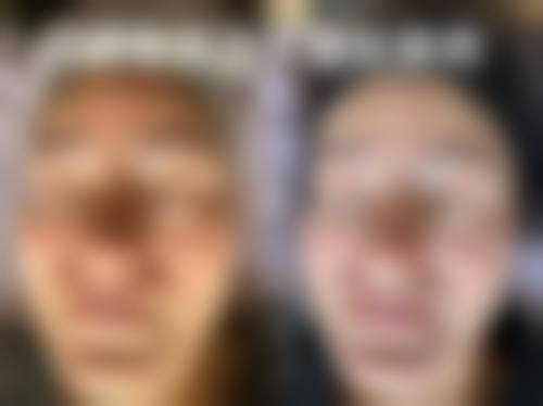 郑州青春源整形美容门诊部正规可靠吗？