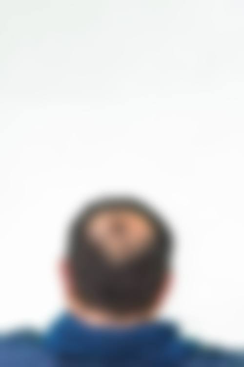 郑州青春源整形美容门诊部患者常见问题解答