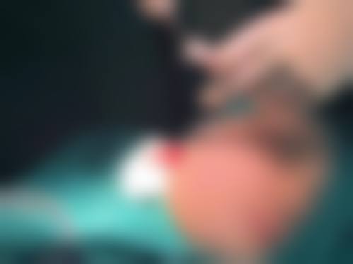 注射隆胸变硬后的日常护理措施