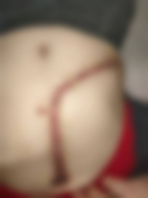 六、甘肃省妇幼保健院整形美容科的预约挂号方式