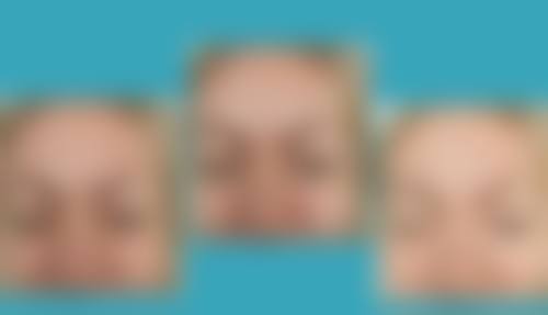 郑州青春源整形美容门诊部价格表 / 收费标准一览