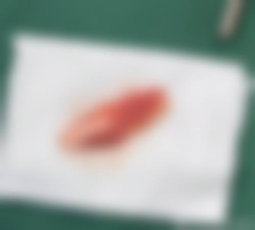 沈阳刘金超擅长什么手术？拉皮、取生长因子及眼鼻整形修复超拿手