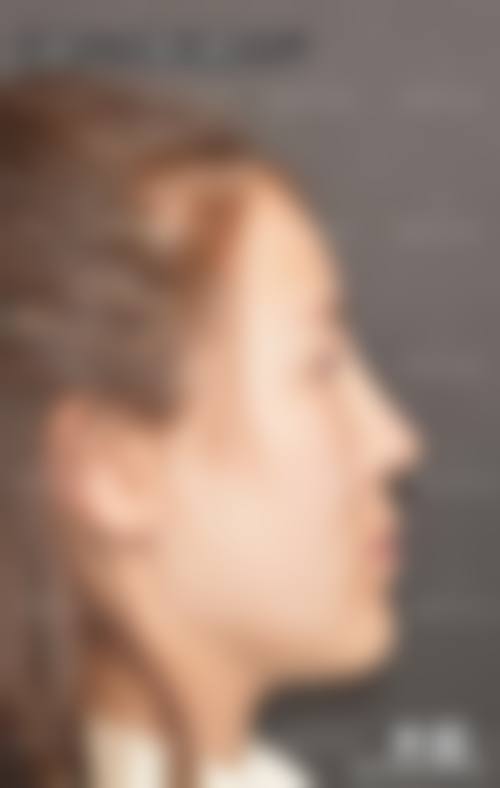 山东济宁壹美天成整形患者常见问题解答