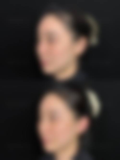 三、珠海九龙整形美容医院的个性化除皱服务