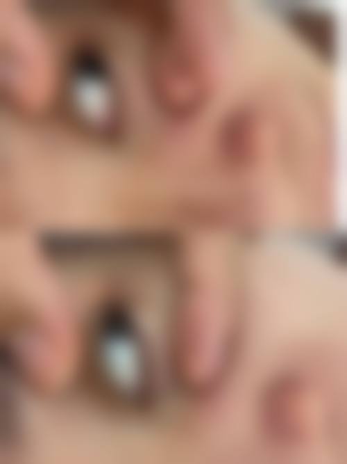 四、西宁开双眼皮医院的服务体验