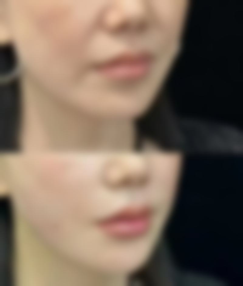 四、吉首星美医疗美容诊所特色诊疗项目及技术优势