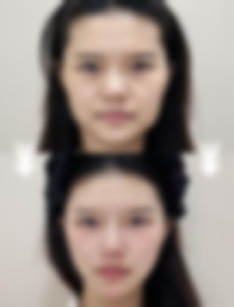 太和县人民医院整形美容科医生名单及擅长领域