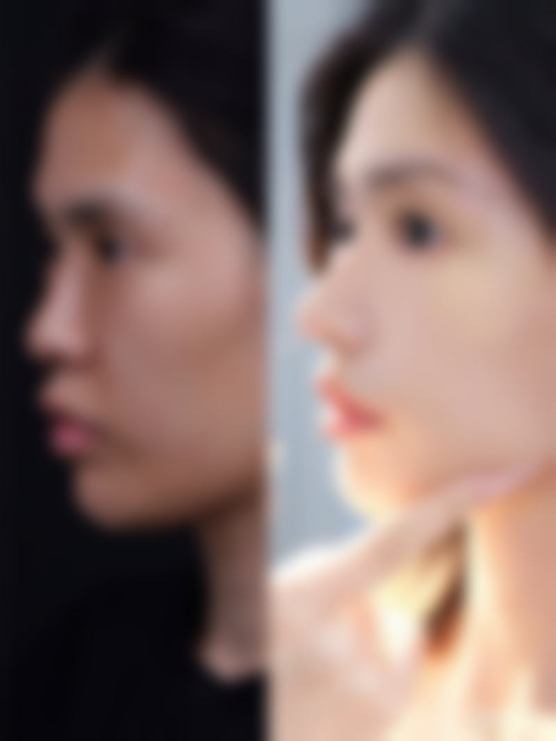 太和县人民医院整形美容科价格表