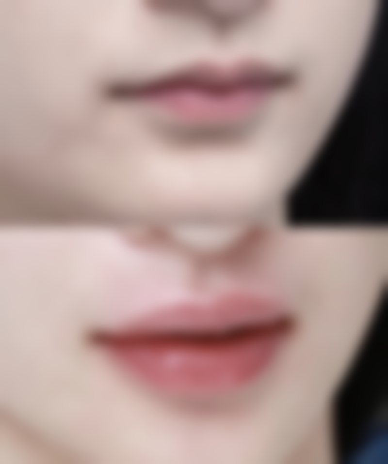 四川内江百龄京菊整形真人口碑评价怎么样？