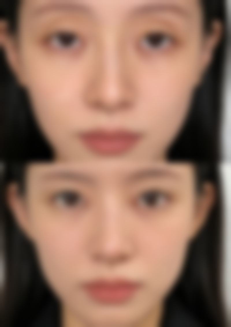 六、北京柏颜整形医院价格区间及收费说明