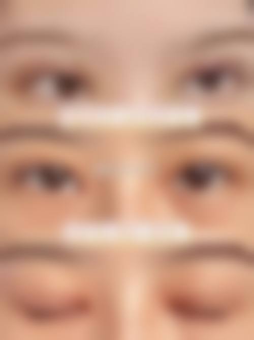 吴坚主医生技术优势