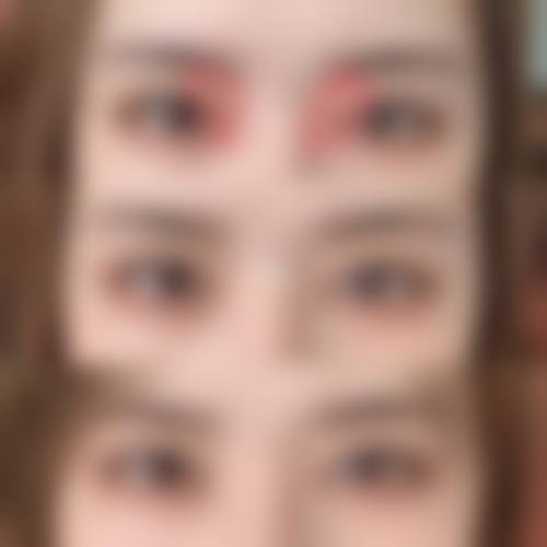 深圳最正规的整形医院哪家靠谱？｜李信锋坐诊宝丽，鼻修复技术拔尖