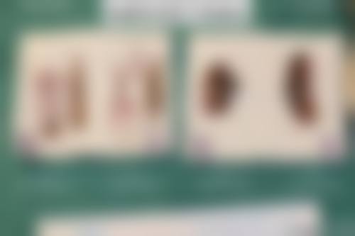 九、患者常见问题解答（精选）