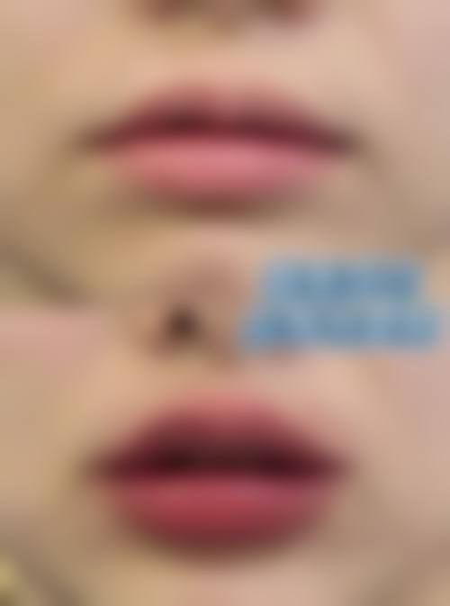 绍兴市中 心医院医疗美容中 心口碑评价