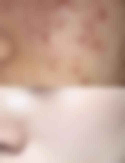 吴坚主医生口碑评价及真人实例