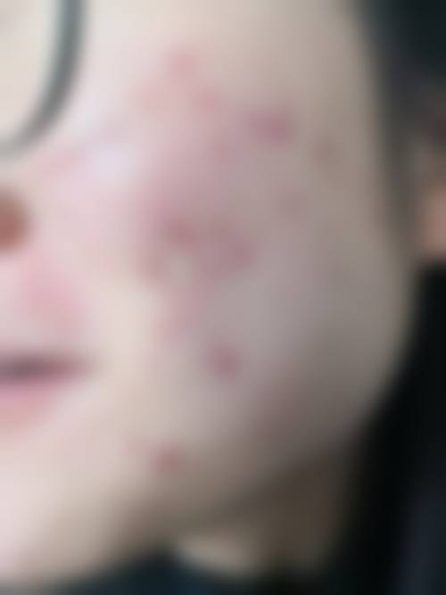 六、东莞星娅整形医院价格区间及收费说明