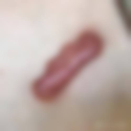 三、深圳美莱整形医院——连锁旗舰的全方面医美服务标杆