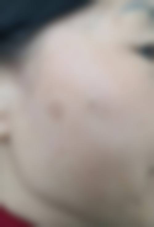 十、东莞星娅整形医院口碑与评价